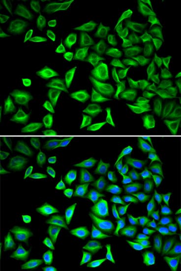 CRP / C-Reactive Protein Antibody