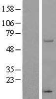 THUMPD3 Protein (Over-Expression Lysate Myc-DDK (Flag))