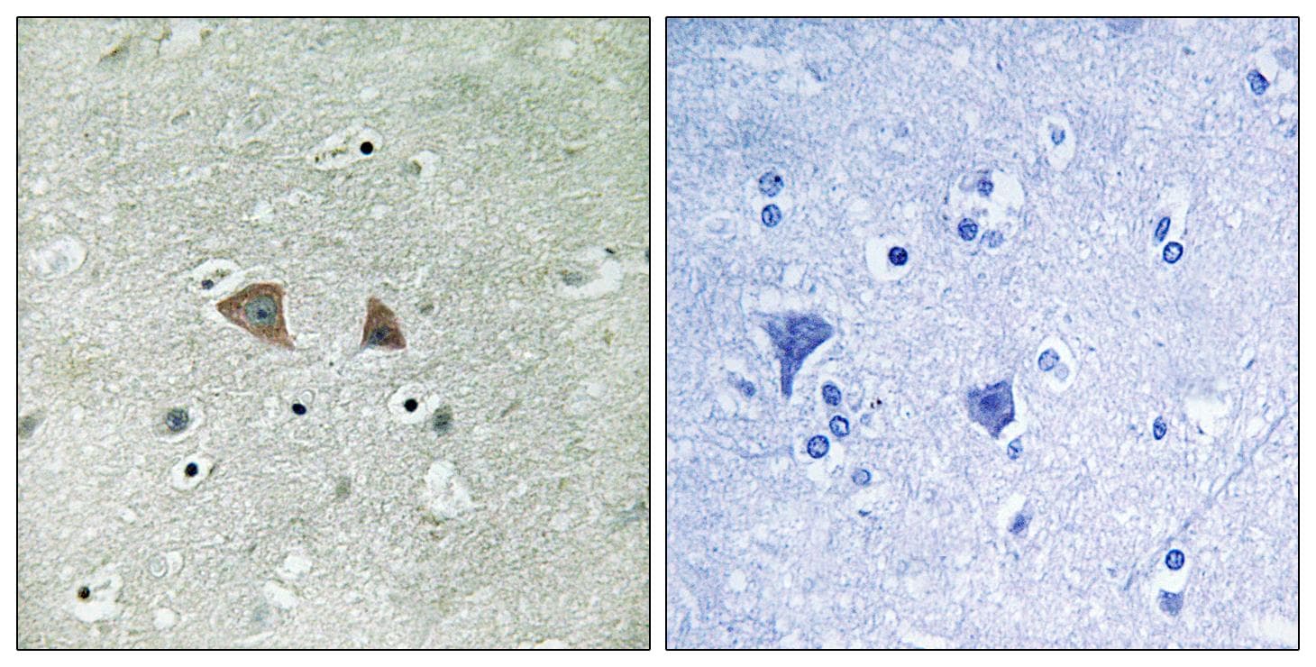 RPS6KB1 / P70S6K / S6K Antibody (p427)