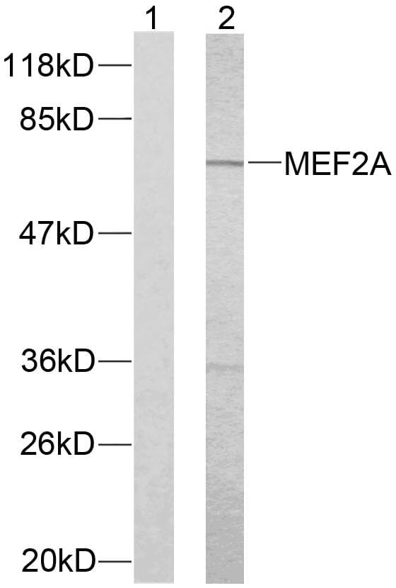 MEF2A / MEF2 Antibody (p312)