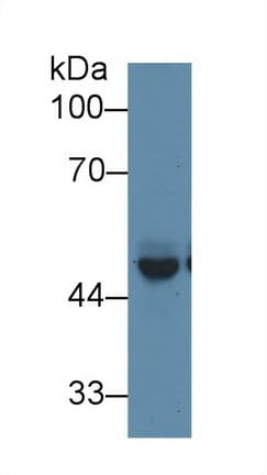 PICK1 Antibody (aa24-229)