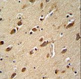 MYLK4 Antibody (aa286-314)
