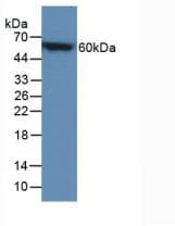 PathPlus™ CALB1 / Calbindin Antibody (aa3-261)