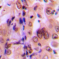 MAP2K1 / MKK1 / MEK1 Antibody (phospho-Thr292)