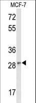 Polyclonal Rabbit anti-Human DAGLB Antibody (aa491-518, WB)