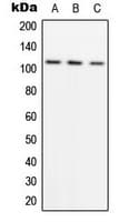 Polyclonal Rabbit anti-Human ADAMTS1 Antibody (Internal, WB)