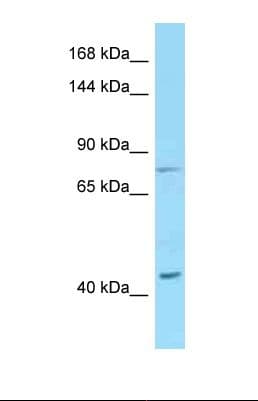 DSG1 / Desmoglein 1 Antibody (C-Terminus)