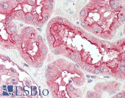 IHC-plus™ PNPLA3 / Adiponutrin Antibody