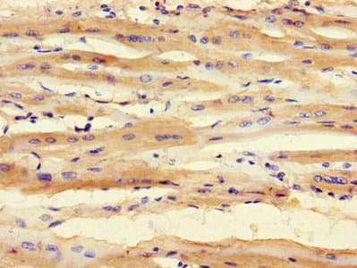 Polyclonal Rabbit anti-Human SMNDC1 Antibody