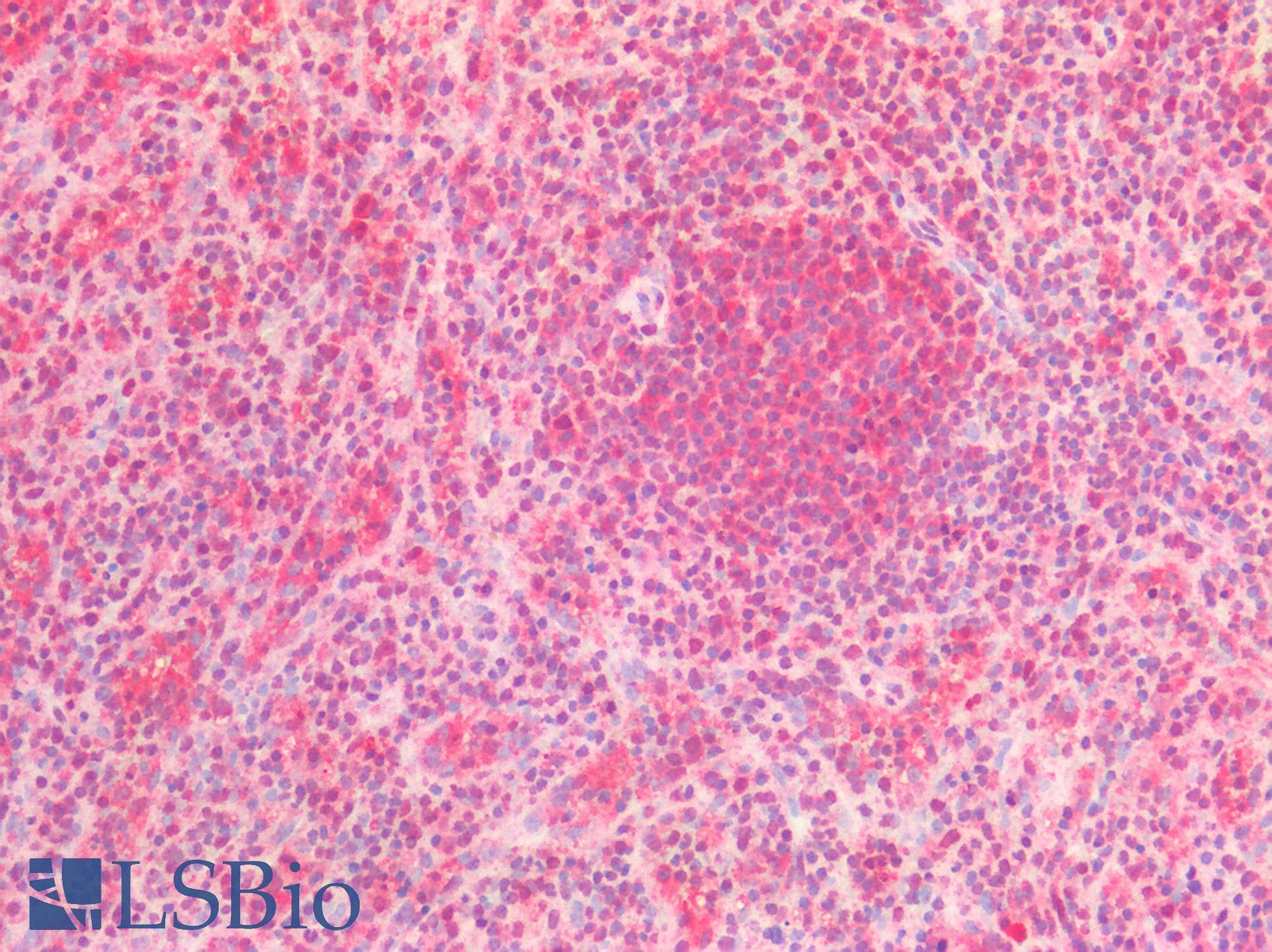 PGD Antibody (clone AT46B3)