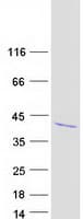 Human IGFBP2 / IGF-BP53 Protein (Recombinant Myc-DDK (Flag))