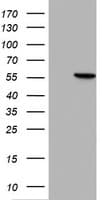 HMBS / PBGD Antibody (clone OTI2F4)