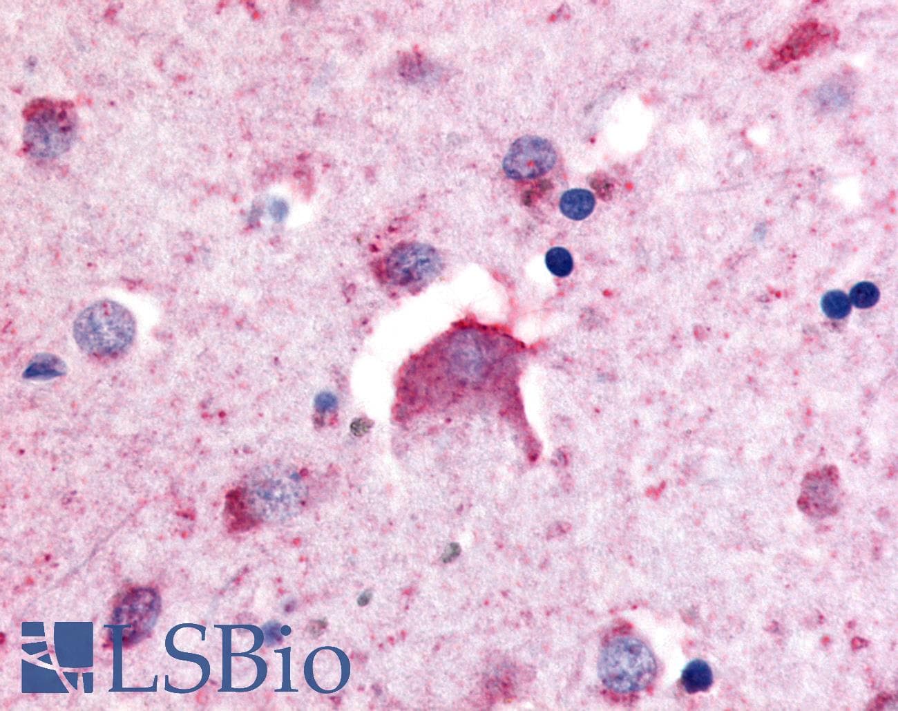 IHC-plus™ DPP6 / Dipeptidylpeptidase 6 Antibody (Internal)