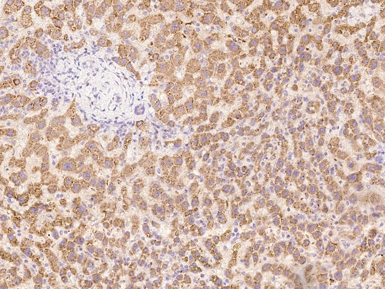 TACR3 / NK3R Antibody