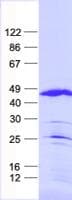 Human DPPA4 Protein (Recombinant His, N-Terminal)