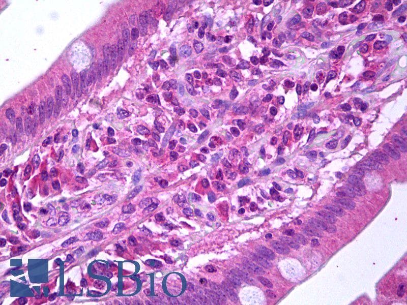 IHC-plus™ FLT4 / VEGFR3 Antibody (clone AFL4)