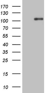 Monoclonal Mouse anti-Human NTRK1 / TrkA Antibody (clone OTI5B6, aa440-796, IHC, WB)