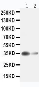 ARG1 / Arginase 1 Antibody (aa307-323)