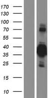 Human BHLHE22 / BHLHB5 Protein (Over-Expression Lysate Myc-DDK (Flag))