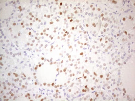 CDKN1A / WAF1 / p21 Antibody (aa2-164, clone OTI7C8)