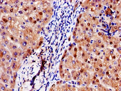 ADAMTS4 Antibody