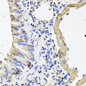 IHC-plus™ Polyclonal Rabbit anti-Human MYH7 Antibody (IHC, WB)