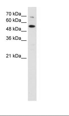 CHEK2 / CHK2 Antibody (N-Terminus)