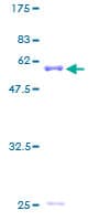 Human AIMP1 / EMAP II Protein (Recombinant GST)