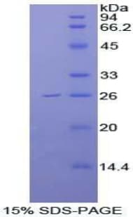 Human FGFR4 Protein (Recombinant His-T7)