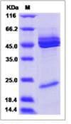Human IL12B + IL23A Heterodimer Protein (Recombinant His,C-terminus)