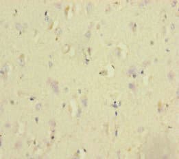 NSMF / NELF Antibody