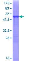 Human ECHDC1 Protein (Recombinant GST)