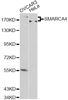 Polyclonal Rabbit anti-Human SMARCA4 / BRG1 Antibody (IHC, IF, WB)