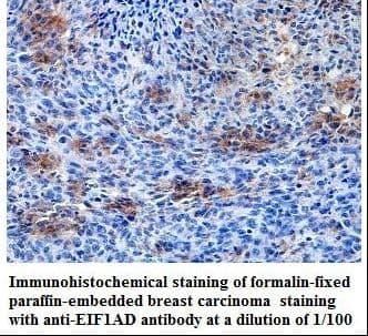 EIF1AD Antibody (aa1-165)