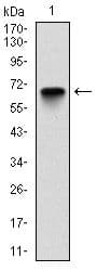 Monoclonal Mouse anti-Human G6PD Antibody (clone 2H7, IHC, WB)