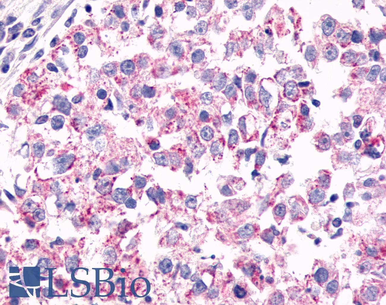 PathPlus™ GPR26 Antibody (Cytoplasmic Domain)
