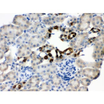 Polyclonal Rabbit anti-Human PGRMC1 / MPR Antibody (aa67-102, IHC, WB)