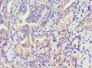 TRIM27 Antibody (aa214-513)