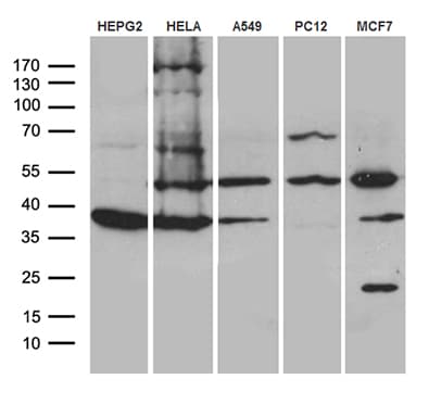 Monoclonal Mouse anti-Human CLP1 Antibody (clone OTI1H7, aa1-226, WB)