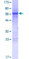 Human SLFN5 Protein (Recombinant GST)