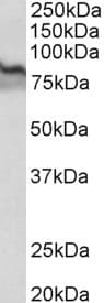TGM2 / Transglutaminase 2 Antibody (aa578-591)