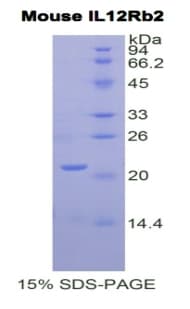 Mouse IL12RB2 Protein (Recombinant His)