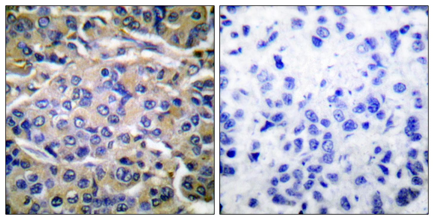 Polyclonal Rabbit anti-Human RPS6KB1 / P70S6K / S6K Antibody (phospho-Thr421, IHC, WB)