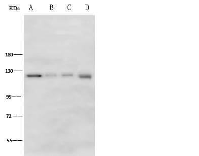 SELP / P-Selectin / CD62P Antibody (Preservative Free)