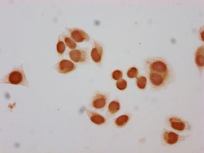 HIST1H2BN Antibody