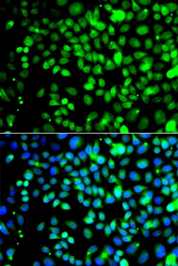 Polyclonal Rabbit anti-Human FRK Antibody (IHC, IF, WB)