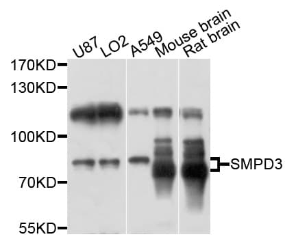 Polyclonal Rabbit anti-Human SMPD3 / NSMASE2 Antibody (WB)