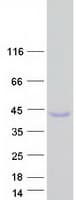 Human NACA Protein (Recombinant Myc-DDK (Flag))