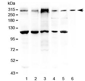 Polyclonal Rabbit anti-Mouse IGF2R / CD222 Antibody (IHC, WB)