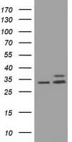 CYB5R3 / B5R Antibody (clone OTI1E3)